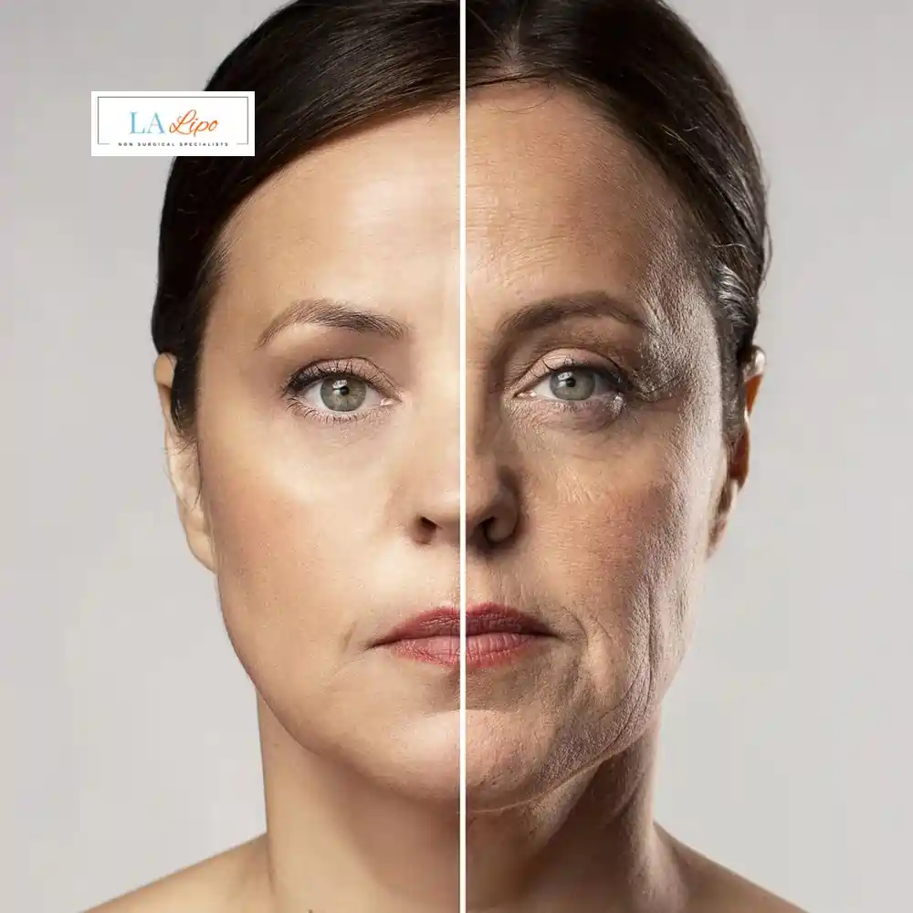 How Can You Tell If Non-Surgical Skin Tightening Is Right for You Milngavie ?