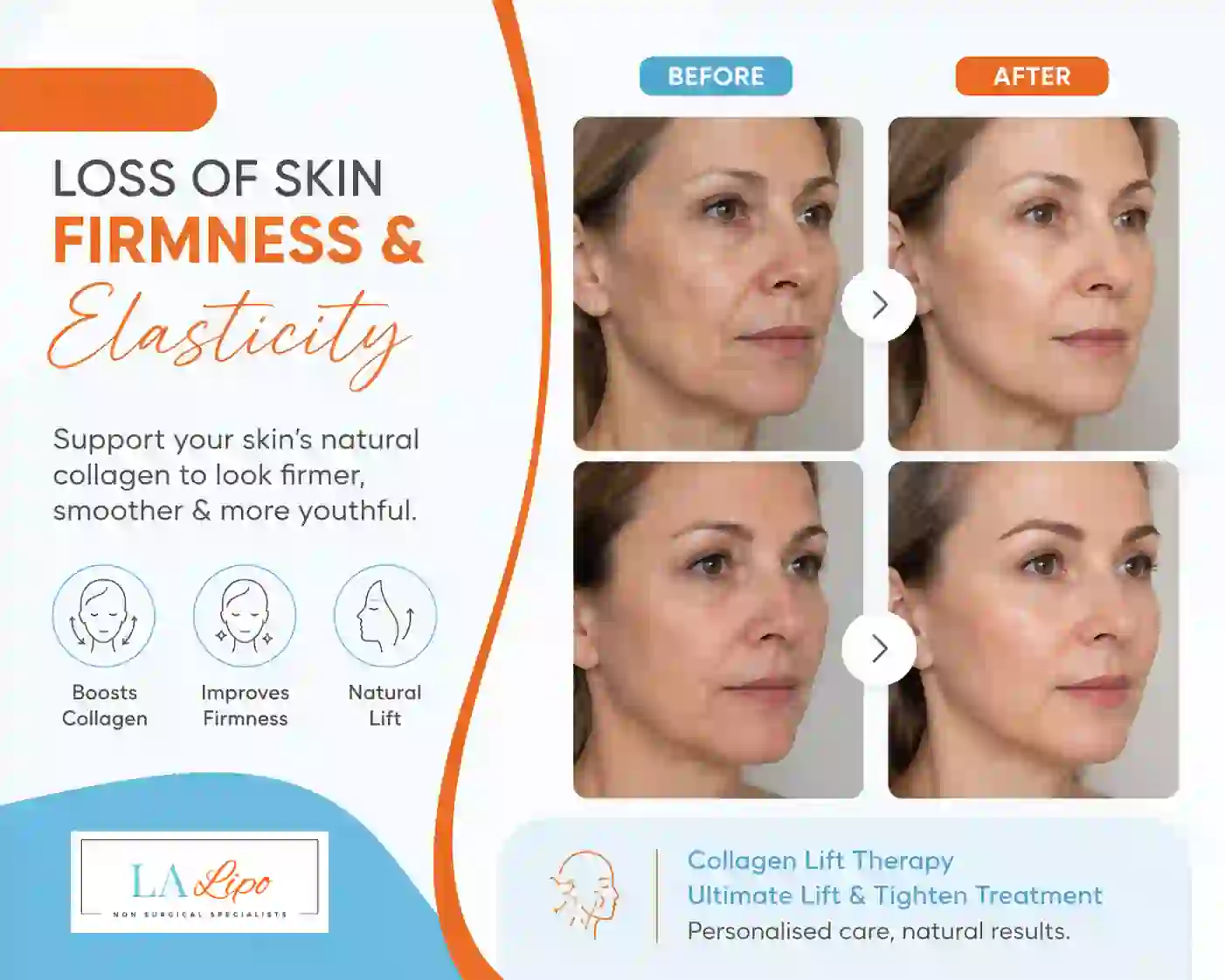 Sign #7: Loss of Skin Firmness and Elasticity Milngavie